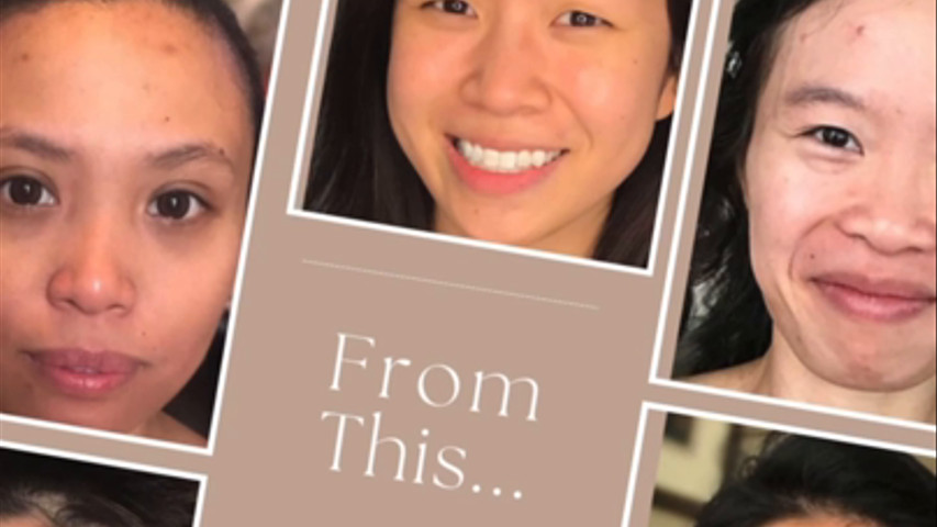 Getting ready with TLT