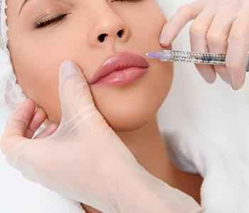 Lip fillers