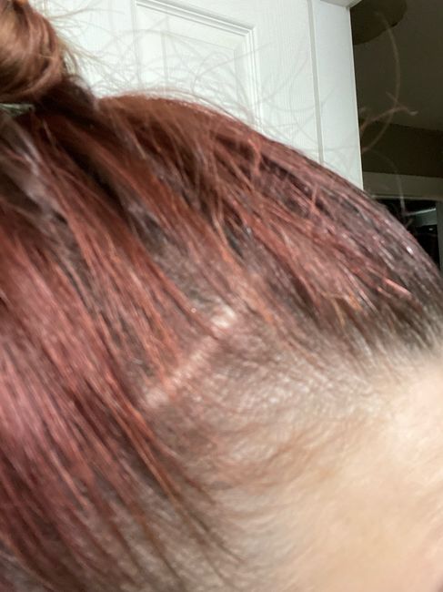 Wyr: Green Hair or no hair? - 1