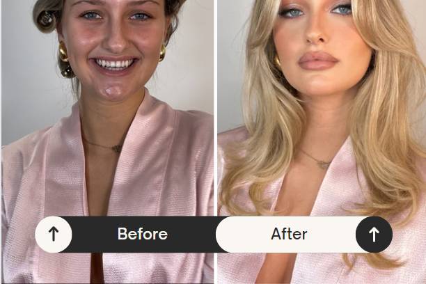 Before and After