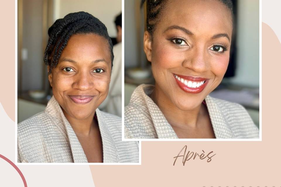 Before and after