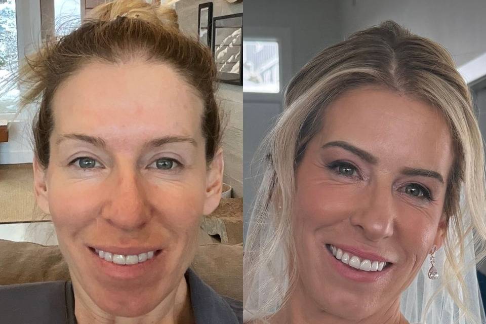 Before and after