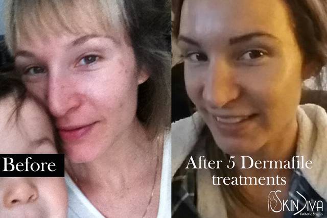 Perfect Appearance Facial