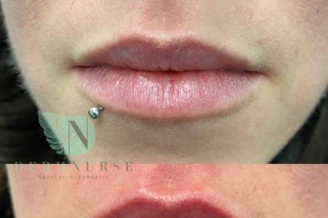 Dermnurse Medical Aesthetics