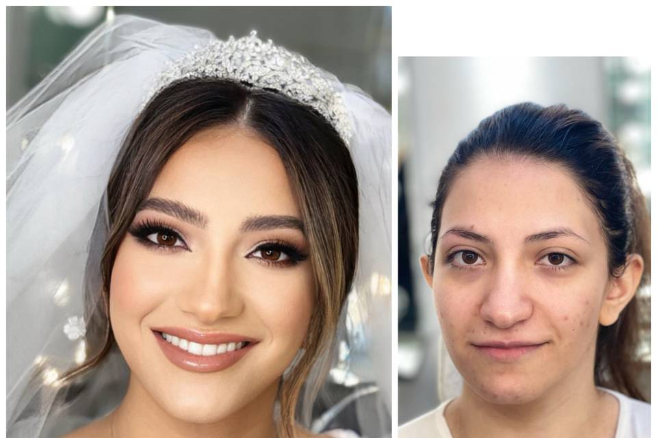 Before & after – natural skin