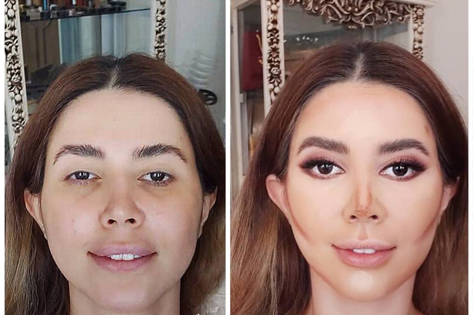 Before & after – flawless skin