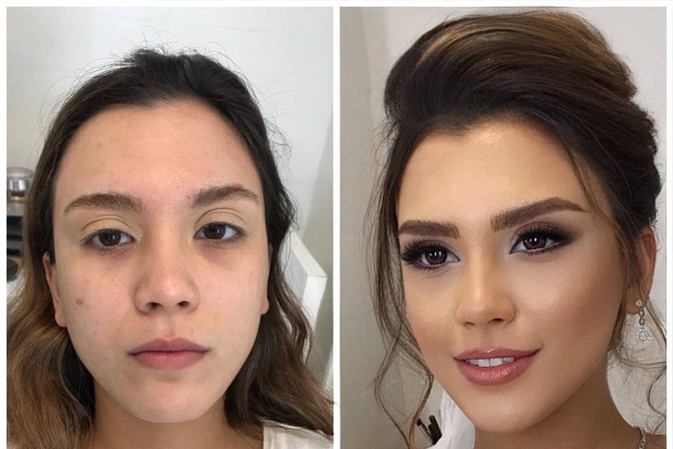 Before & after – natural brida